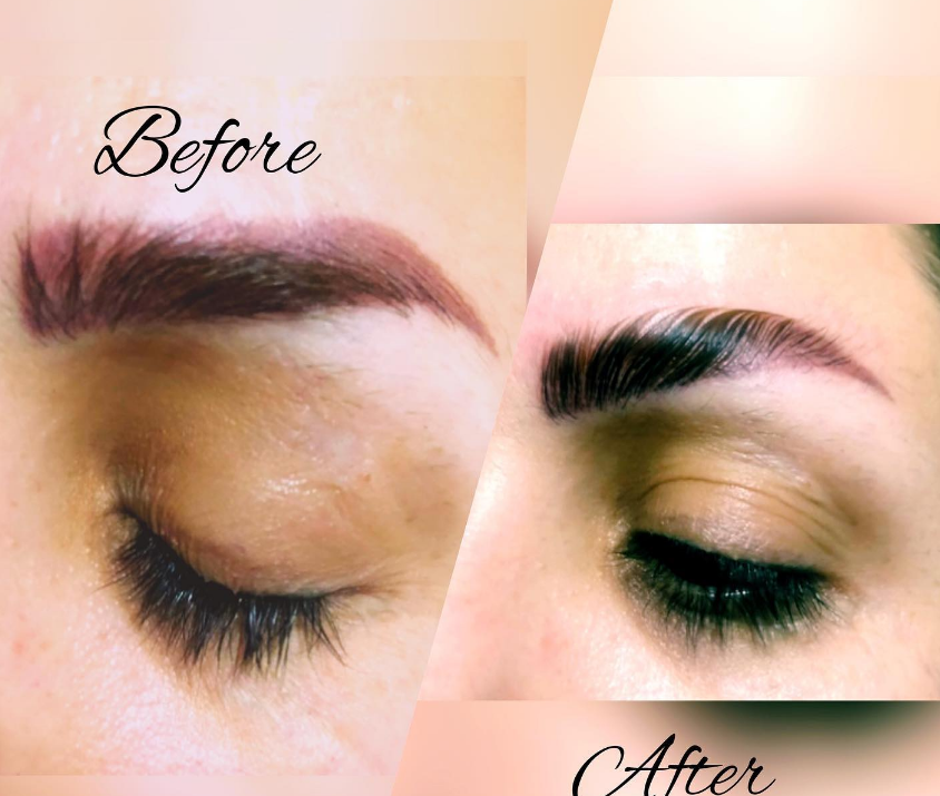 لیفت ابروی یه لیفت ابروی جذاب